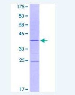 Novus Biologicals Recombinant Human Integrin alpha 2/CD49b GST (N-Term) Protein 10 &mu;g | Buy Online | Novus Biologicals&trade; | Fisher Scientific