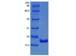 Novus Biologicals Recombinant Human IFN-alpha 2 Protein 100 &mu;g | Buy Online | Novus Biologicals&trade; | Fisher Scientific