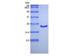 Novus Biologicals Recombinant Human IFN-alpha 2 Protein 1 mg | Buy Online | Novus Biologicals&trade; | Fisher Scientific