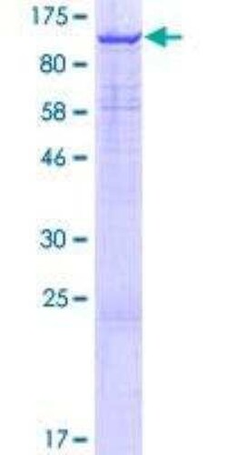 Novus Biologicals Recombinant Human JMJD1B GST (N-Term) Protein 10 &mu;g | Buy Online | Novus Biologicals&trade; | Fisher Scientific