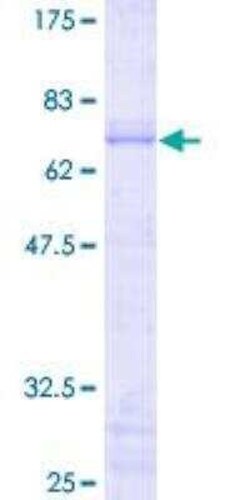Novus Biologicals Recombinant Human JunB/AP-1 GST (N-Term) Protein 2 &mu;g | Buy Online | Novus Biologicals&trade; | Fisher Scientific