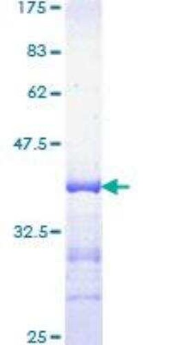 Novus Biologicals Recombinant Human KAT3B/p300 GST (N-Term) Protein 25 &mu;g | Buy Online | Novus Biologicals&trade; | Fisher Scientific