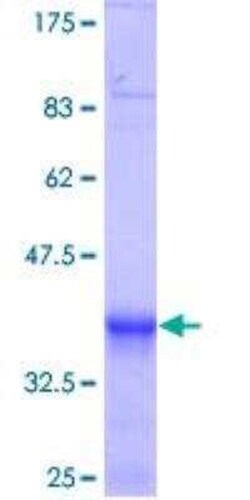 Novus Biologicals Recombinant Human KBTBD10 GST (N-Term) Protein 10 &mu;g | Buy Online | Novus Biologicals&trade; | Fisher Scientific