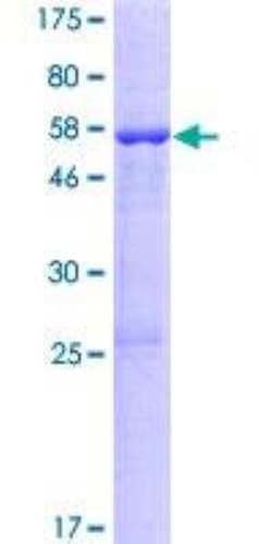 Novus Biologicals Recombinant Human KCNRG GST (N-Term) Protein 10 &mu;g | Buy Online | Novus Biologicals&trade; | Fisher Scientific