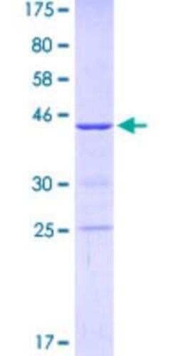 Novus Biologicals Recombinant Human KIF1C GST (N-Term) Protein 25 &mu;g | Buy Online | Novus Biologicals&trade; | Fisher Scientific