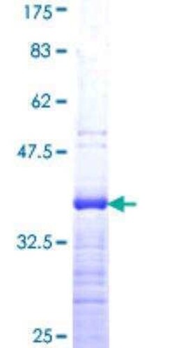 Novus Biologicals Recombinant Human KLF5 GST (N-Term) Protein 10 &mu;g | Buy Online | Novus Biologicals&trade; | Fisher Scientific