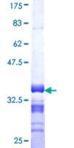 Novus Biologicals Recombinant Human KLF9 GST (N-Term) Protein 10 &mu;g | Buy Online | Novus Biologicals&trade; | Fisher Scientific