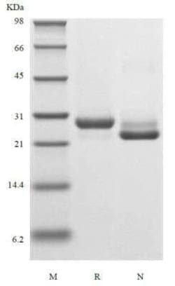 Novus Biologicals Recombinant Human Kallikrein 3/PSA Protein 5 &mu;g | Buy Online | Novus Biologicals&trade; | Fisher Scientific