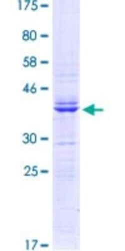 Novus Biologicals Recombinant Human LSD1 GST (N-Term) Protein 10 &mu;g | Buy Online | Novus Biologicals&trade; | Fisher Scientific