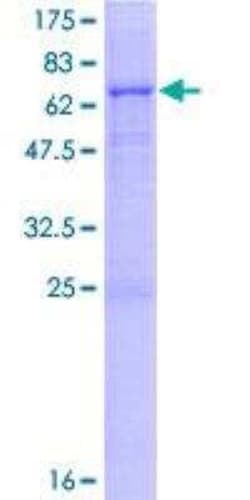 Novus Biologicals Recombinant Human LYPLA3 GST (N-Term) Protein 2 &mu;g | Buy Online | Novus Biologicals&trade; | Fisher Scientific