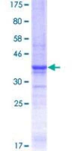 R&D Systems&trade;&nbsp;Recombinant Human Laminin alpha 5 GST (N-Term) Protein