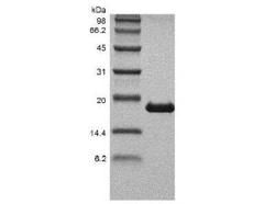 Novus Biologicals Recombinant Human Lymphotoxin-alpha/TNF-beta Protein 500 &mu;g | Buy Online | Novus Biologicals&trade; | Fisher Scientific