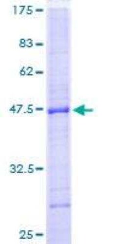 Novus Biologicals&trade;&nbsp;Recombinant Human Lyp/PTPN22 GST (N-Term) Protein