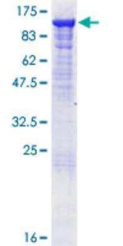 Novus Biologicals Recombinant Human MALT1 GST (N-Term) Protein 10 &mu;g | Buy Online | Novus Biologicals&trade; | Fisher Scientific