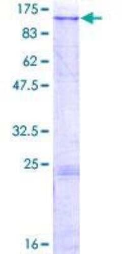 Novus Biologicals Recombinant Human MAN2B2 GST (N-Term) Protein 2 &mu;g | Buy Online | Novus Biologicals&trade; | Fisher Scientific