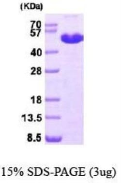 Novus Biologicals&trade;&nbsp;Recombinant Human MAT1A His Protein