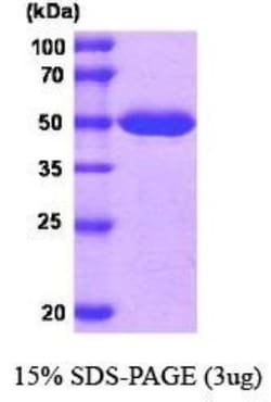Novus Biologicals&trade;&nbsp;Recombinant Human MAT2A Protein
