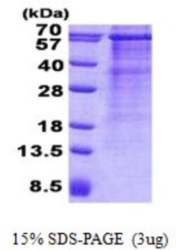 Novus Biologicals&trade;&nbsp;Recombinant Human MAVS His Protein