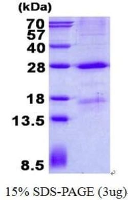 Novus Biologicals&trade;&nbsp;Recombinant Human MBL His Protein