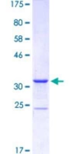 Novus Biologicals Recombinant Human MEF2B GST (N-Term) Protein 25 &mu;g | Buy Online | Novus Biologicals&trade; | Fisher Scientific