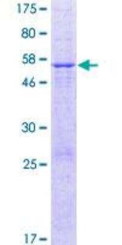 Novus Biologicals Recombinant Human METTL20 GST (N-Term) Protein 25 &mu;g | Buy Online | Novus Biologicals&trade; | Fisher Scientific