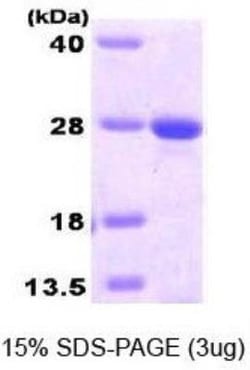 Novus Biologicals&trade;&nbsp;Recombinant Human MGMT His Protein