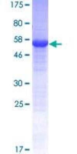 Novus Biologicals Recombinant Human MIOX GST (N-Term) Protein 10 &mu;g | Buy Online | Novus Biologicals&trade; | Fisher Scientific