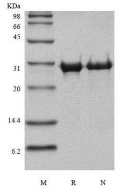 Novus Biologicals Recombinant Human MMP-14/MT1-MMP Protein 100 &mu;g:Proteínas