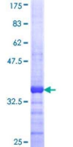 Novus Biologicals Recombinant Human MPPED1 GST (N-Term) Protein 25 &mu;g | Buy Online | Novus Biologicals&trade; | Fisher Scientific