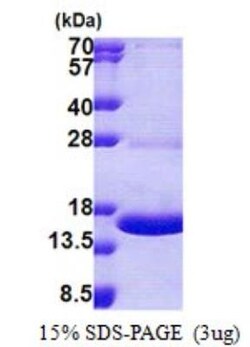 Novus Biologicals&trade;&nbsp;Recombinant Human MPZL1 His Protein