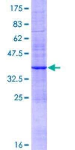 Novus Biologicals Recombinant Human MRP6 GST (N-Term) Protein 10 &mu;g | Buy Online | Novus Biologicals&trade; | Fisher Scientific