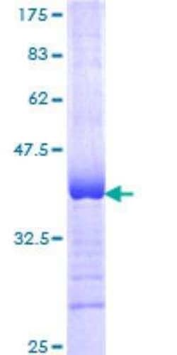 Novus Biologicals Recombinant Human MRP6 GST (N-Term) Protein 25 &mu;g | Buy Online | Novus Biologicals&trade; | Fisher Scientific