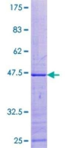Novus Biologicals Recombinant Human MRPL49 GST (N-Term) Protein 10 &mu;g | Buy Online | Novus Biologicals&trade; | Fisher Scientific