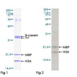 Novus Biologicals Recombinant Human MSK1/RPS6KA5 GST (N-Term) Protein 25 &mu;g | Buy Online | Novus Biologicals&trade; | Fisher Scientific
