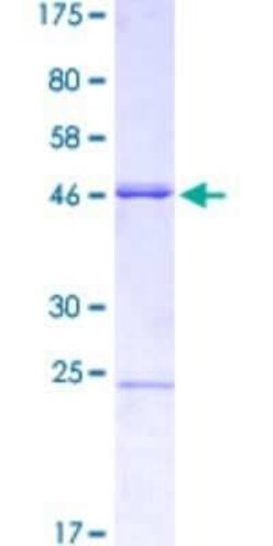 Novus Biologicals Recombinant Human MSX2 GST (N-Term) Protein 10 &mu;g | Buy Online | Novus Biologicals&trade; | Fisher Scientific