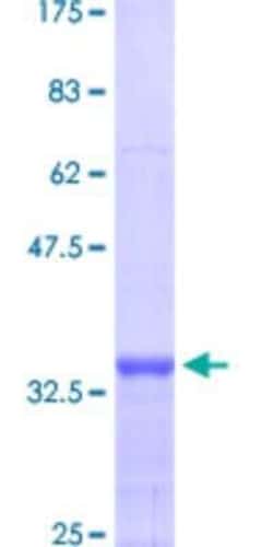 Novus Biologicals Recombinant Human MTA1 GST (N-Term) Protein 10 &mu;g | Buy Online | Novus Biologicals&trade; | Fisher Scientific