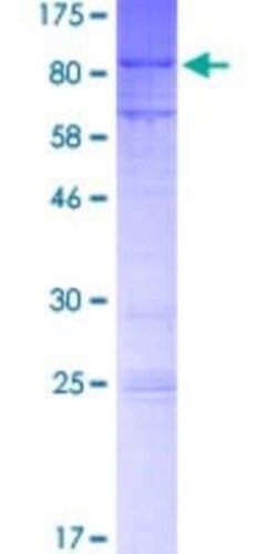 Novus Biologicals Recombinant Human MTF2 GST (N-Term) Protein 2 &mu;g | Buy Online | Novus Biologicals&trade; | Fisher Scientific