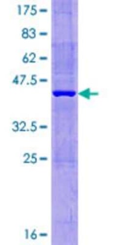 Novus Biologicals Recombinant Human MTHFD2L GST (N-Term) Protein 10 &mu;g | Buy Online | Novus Biologicals&trade; | Fisher Scientific