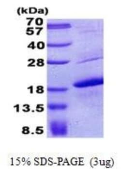 Novus Biologicals&trade;&nbsp;Recombinant Human Melan-A/MART-1 His Protein