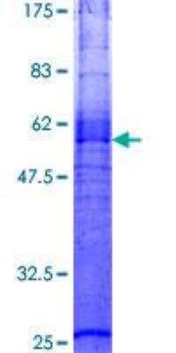 Novus Biologicals Recombinant Human Melanocortin-3 R/MC3R GST (N-Term) Protein 2 &mu;g | Buy Online | Novus Biologicals&trade; | Fisher Scientific