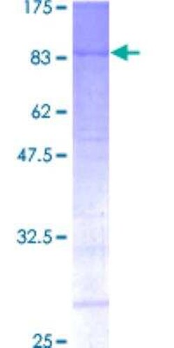 Novus Biologicals Recombinant Human Menin GST (N-Term) Protein 2 &mu;g | Buy Online | Novus Biologicals&trade; | Fisher Scientific