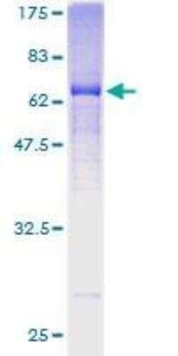Novus Biologicals Recombinant Human Mindin/Spondin-2 GST (N-Term) Protein 2 &mu;g | Buy Online | Novus Biologicals&trade; | Fisher Scientific