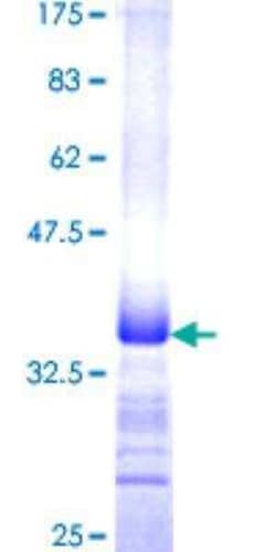 Novus Biologicals Recombinant Human MUC5AC GST (N-Term) Protein 25 &mu;g | Buy Online | Novus Biologicals&trade; | Fisher Scientific