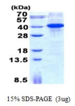 Novus Biologicals&trade;&nbsp;Recombinant Human MyD88 His Protein
