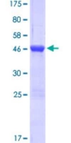 Novus Biologicals Recombinant Human Myosin light chain kinase GST (N-Term) Protein 10 &mu;g | Buy Online | Novus Biologicals&trade; | Fisher Scientific