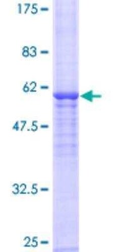 Novus Biologicals Recombinant Human NAT2 GST (N-Term) Protein 10 &mu;g | Buy Online | Novus Biologicals&trade; | Fisher Scientific