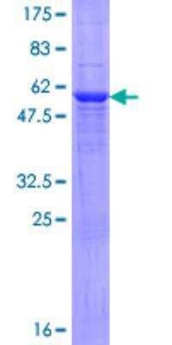 Novus Biologicals Recombinant Human NAT2 GST (N-Term) Protein 10 &mu;g | Buy Online | Novus Biologicals&trade; | Fisher Scientific