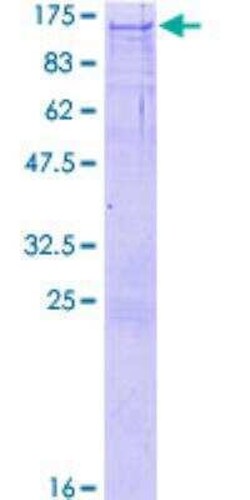 Novus Biologicals Recombinant Human NBR1 GST (N-Term) Protein 2 &mu;g | Buy Online | Novus Biologicals&trade; | Fisher Scientific
