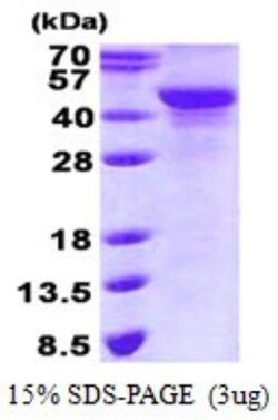 Novus Biologicals&trade;&nbsp;Recombinant Human NDRG2 His Protein
