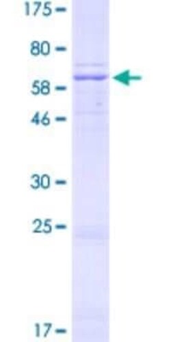 Novus Biologicals Recombinant Human NDUFA9 GST (N-Term) Protein 10 &mu;g | Buy Online | Novus Biologicals&trade; | Fisher Scientific